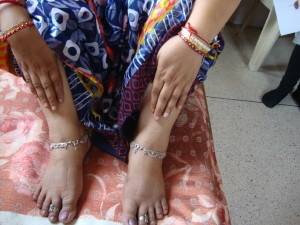 Minaben' hands and feet after fifteen days