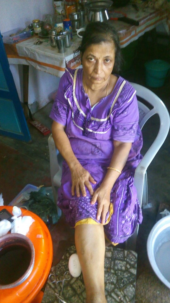 After Treatment